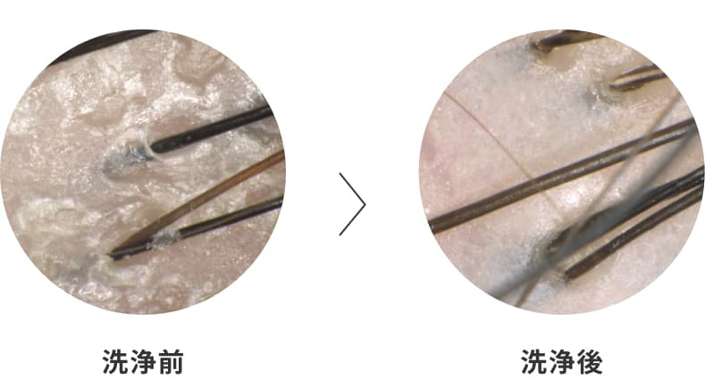 毛穴改善のimg